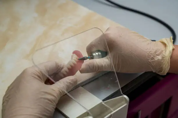 Implantologia — Studio Medico Odontoiatrico Ferrari & Soli