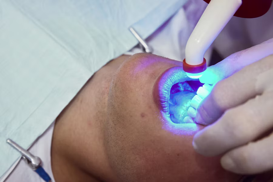 Sbiancamento denti professionale in studio — Studio Medico Odontoiatrico Ferrari & Soli