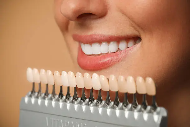 Sorriso perfetto con trattamenti di estetica dentale — Studio Medico Odontoiatrico Ferrari & Soli